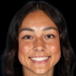 Emily Fojo